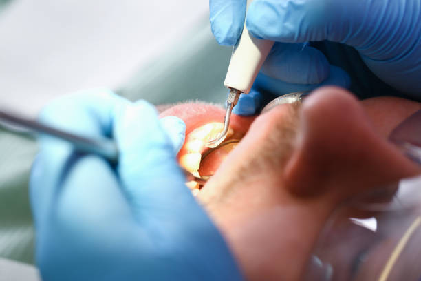 Best Teeth Whitening  in Tchula, MS