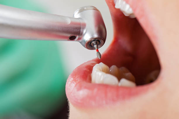 Best Broken Tooth Emergency  in Tchula, MS